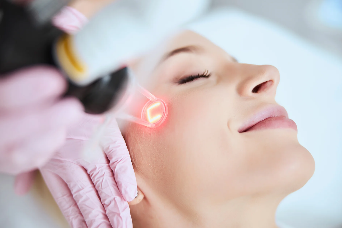 CO2 Laser Resurfacing Service